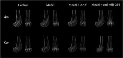 Adenovirus-associated anti-miRNA-214 regulates bone metabolism and prevents local osteoporosis in rats